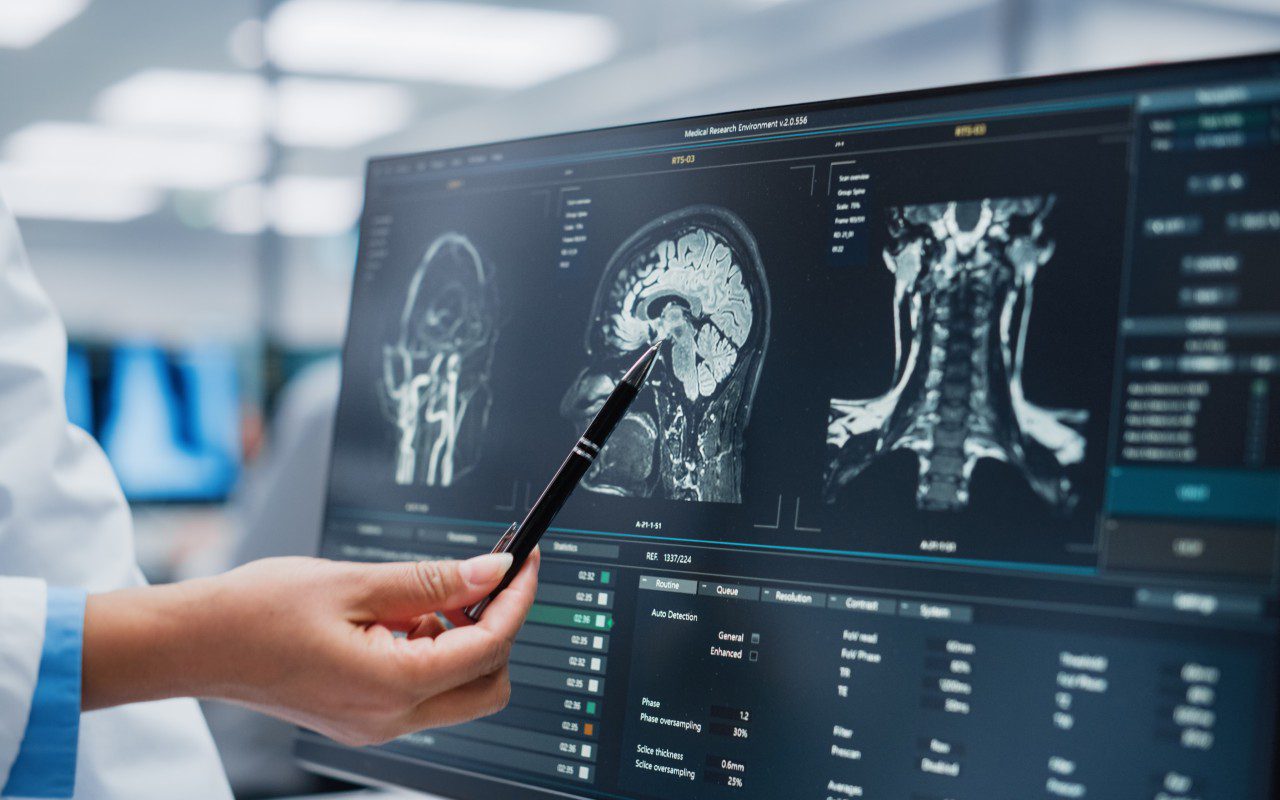 Physician pointing at digital brain imaging